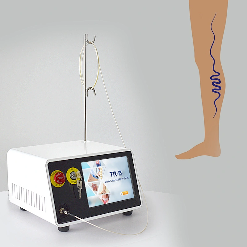 TRIANGEL Laser Fiber For Evlt Treatment 980nm 1470nm Evla Varicose Veins Treatment Machine