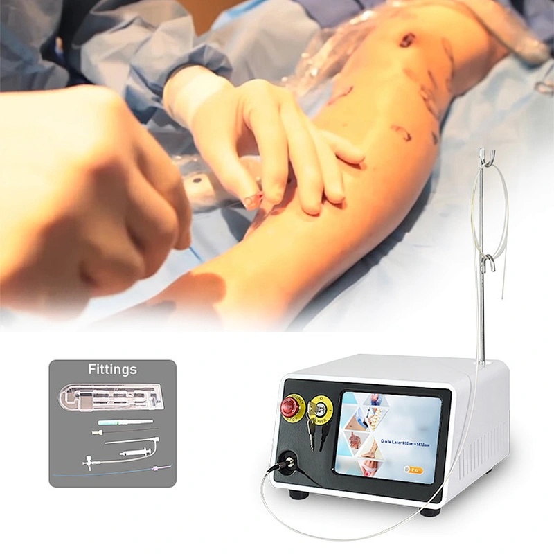 TRIANGEL Laser Fiber For Evlt Treatment 980nm 1470nm Evla Varicose Veins Treatment Machine